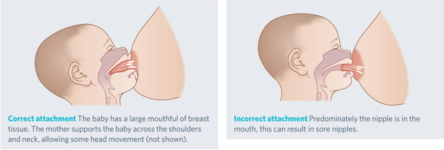 Breastfeeding your baby in hospital: positioning and attachment