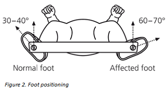 Foot-positioning