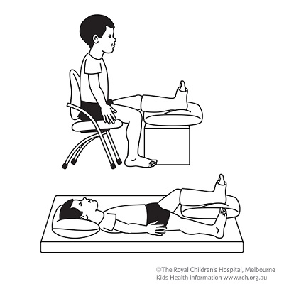 Exercises for an Ankle in a Cast