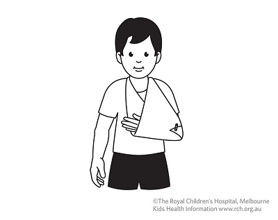 Fracture care: clavicle sling