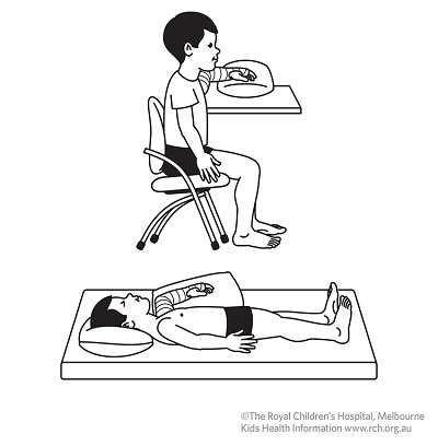 Fracture care: supracondular elbow elevated