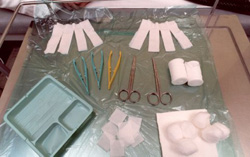 Hoffman ilizarov infectiosn etc 016.jpg