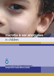 Microtia & Ear Anomoliesr