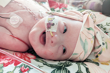 Help provide life-saving care for children like Aurora