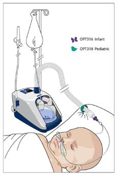 high flow nasal cannula pediatrics