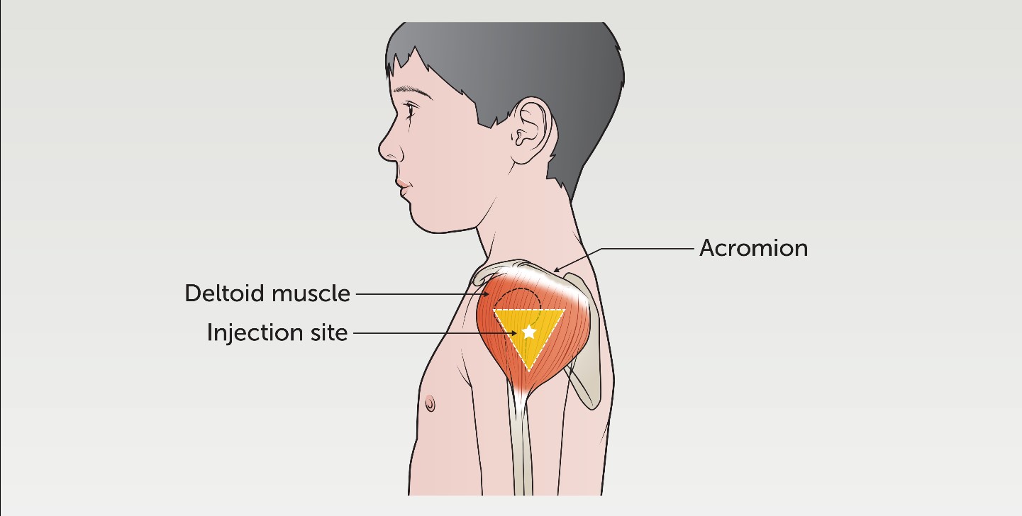 Deltoid_IM Injections