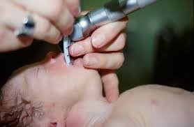 clinical guidelines nursing assisting with elective intubation