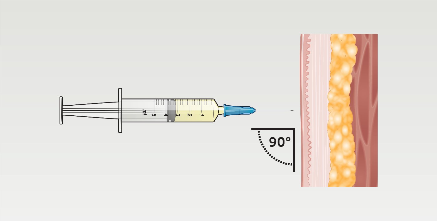 vastus lateralis injection