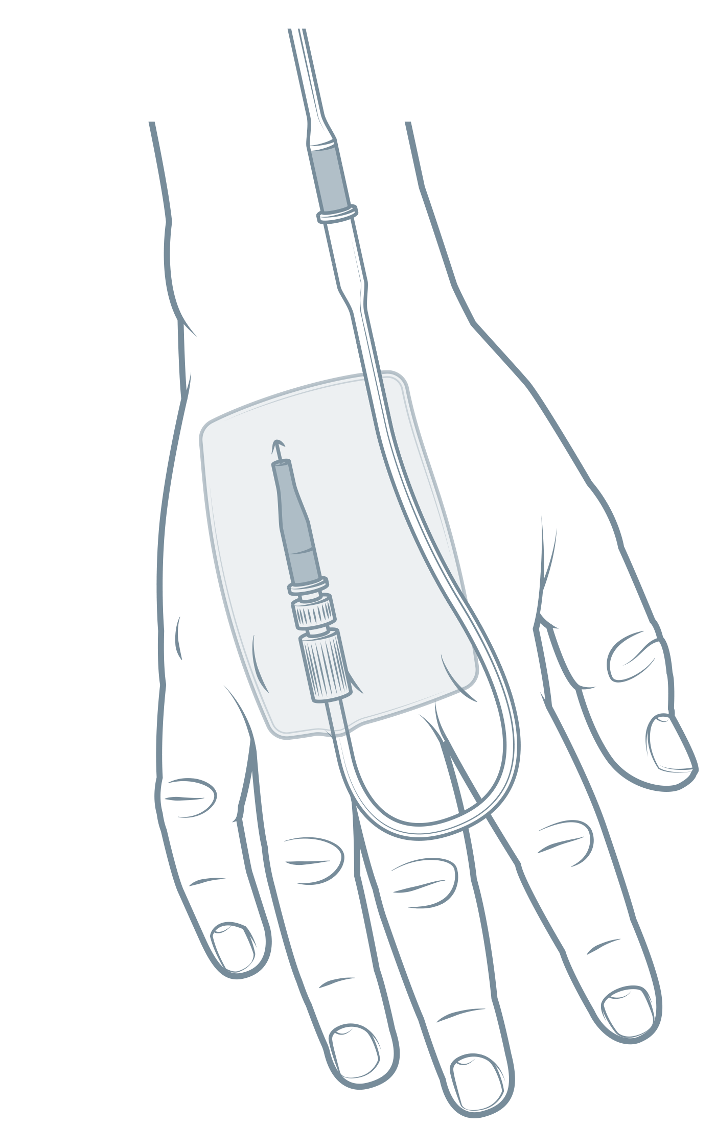 Nursing guidelines : Peripheral intravenous (IV) device management