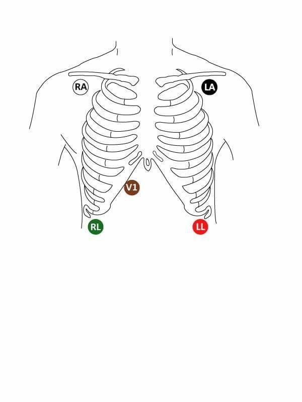 Telemetry Telemetry
