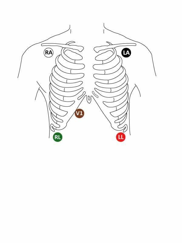 Nursing guidelines : Cardiac telemetry