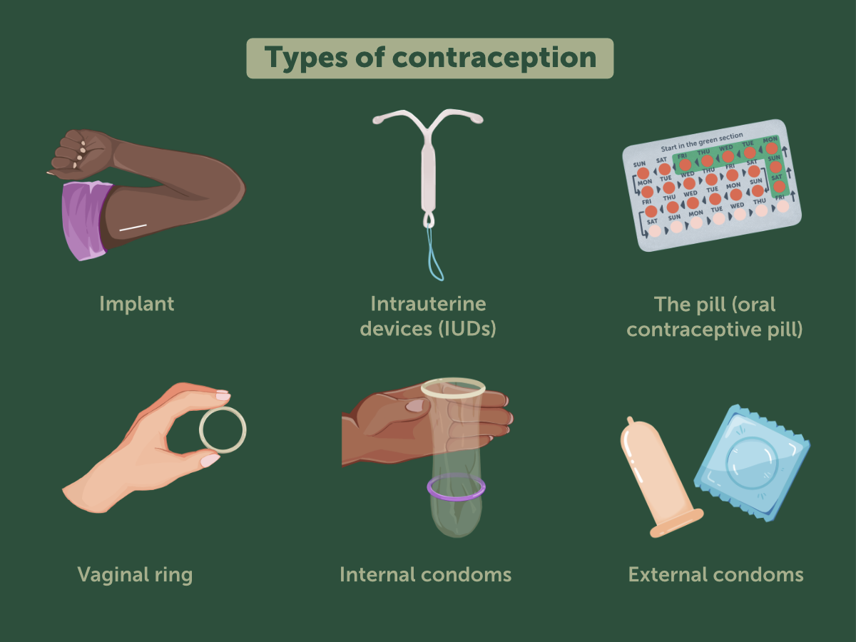 Illustration showing six of the most common types of contraception for young people. Top row, left-to-right: implant, intrauterine devices (IUDs), the pill (oral contraceptive pill). Bottom row, left-to-right: vaginal ring, internal condoms, external condoms.