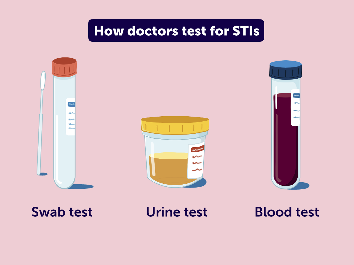 Illustration with the three main test types of STIs.