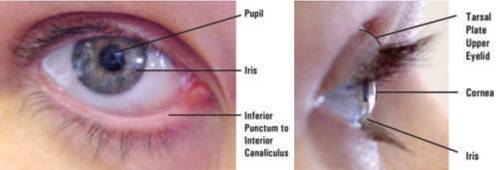 Eye diagram